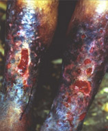 Photo of the legs of a victim of anthrax attack in 1942 in Zhejiang Province